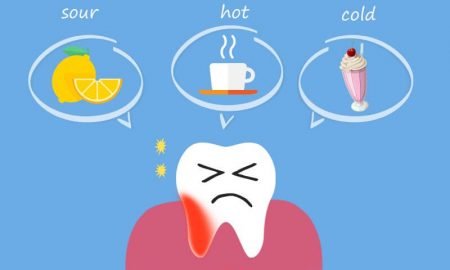 Treatments for Sensitive Teeth